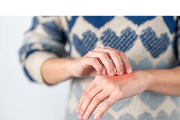 Ways to Prevent Hand Dermatitis