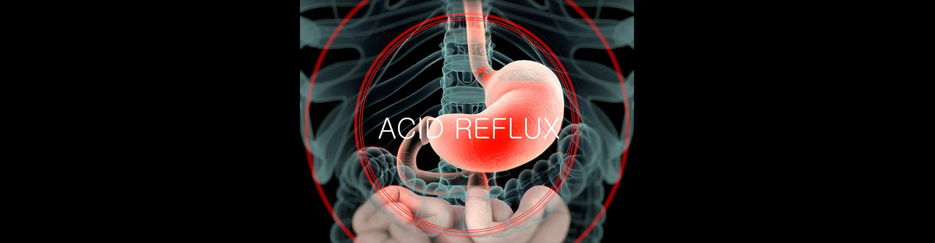 Is Bacon Bad for Acid Reflux? – GoodGut Nutrition